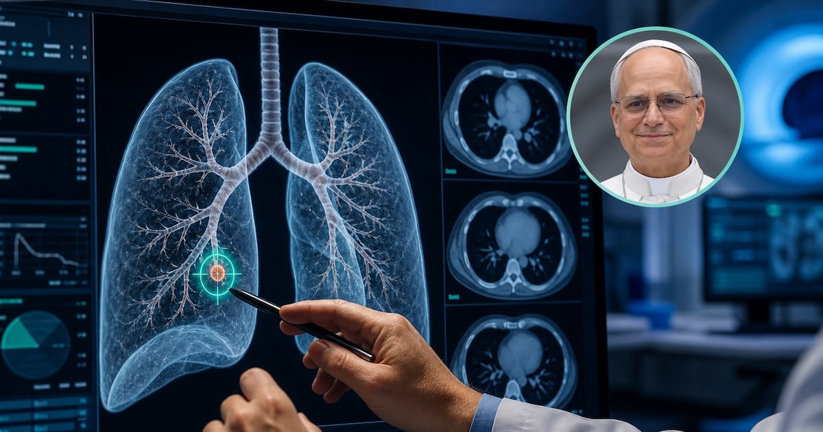 Tres milímetros, una decisión: la cirugía del Papa y lo que enseña sobre los nódulos pulmonares